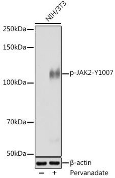 Immunology Antibodies 3 Anti-Phospho-JAK2-Y1007 Antibody CABP0917