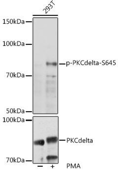 Cell Death Antibodies 2 Anti-Phospho-PKCdelta-S645 Antibody CABP0972