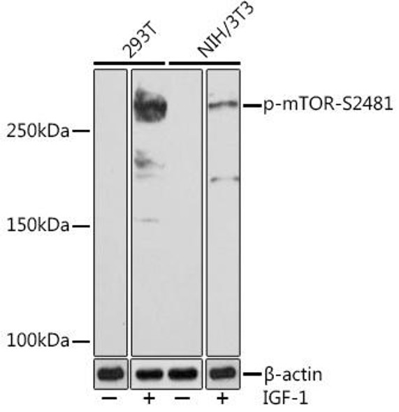 Cell Biology Antibodies 14 Anti-Phospho-mTOR-S2481 Antibody CABP0978