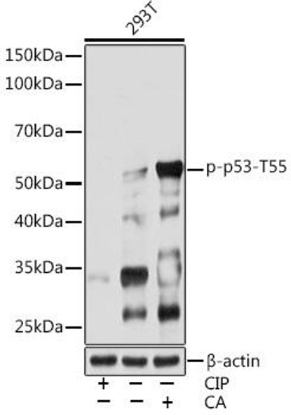 Cell Death Antibodies 2 Anti-Phospho-p53-T55 Antibody CABP0986
