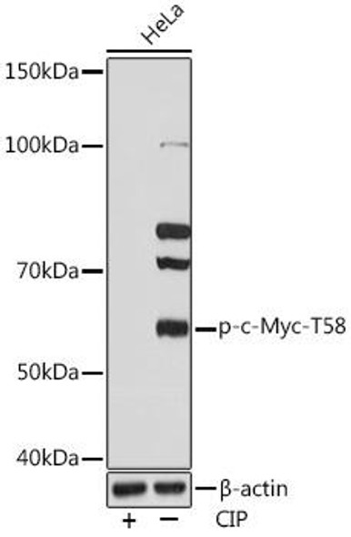 Epigenetics and Nuclear Signaling Antibodies 5 Anti-Phospho-c-Myc-T58 Antibody CABP0990