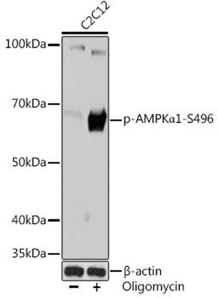 Autophagy Antibodies Anti-Phospho-AMPKAlpha1-S496 Antibody CABP1002