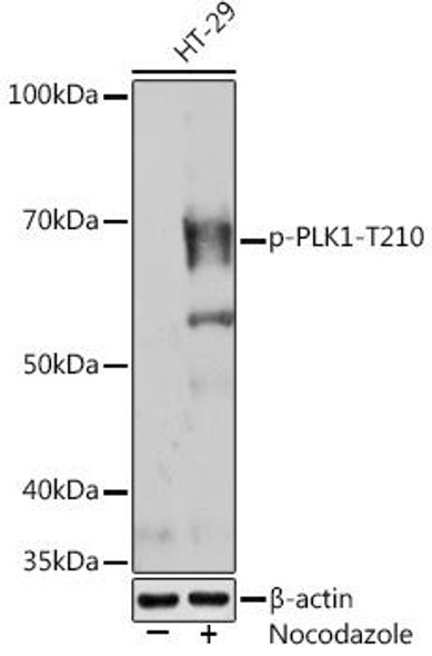 Cell Cycle Antibodies 2 Anti-Phospho-PLK1-T210 Antibody CABP1025