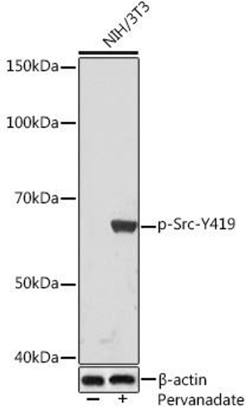 Cell Biology Antibodies 14 Anti-Phospho-Src-Y419 Antibody CABP1027