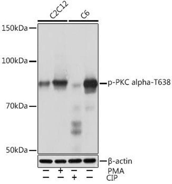 Cardiovascular Antibodies Anti-Phospho-PKC alpha-T638 Antibody CABP1045