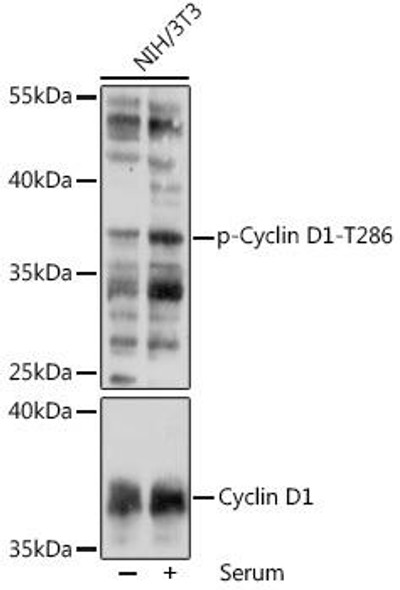 Cell Cycle Antibodies 2 Anti-Phospho-Cyclin D1-T286 Antibody CABP1061