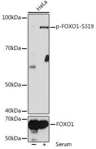 Cell Death Antibodies 2 Anti-Phospho-FOXO1-S319 Antibody CABP1090