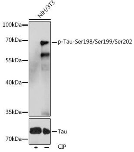 Cell Biology Antibodies 14 Anti-Phospho-Tau-Ser198/Ser199/Ser202 Antibody CABP1096