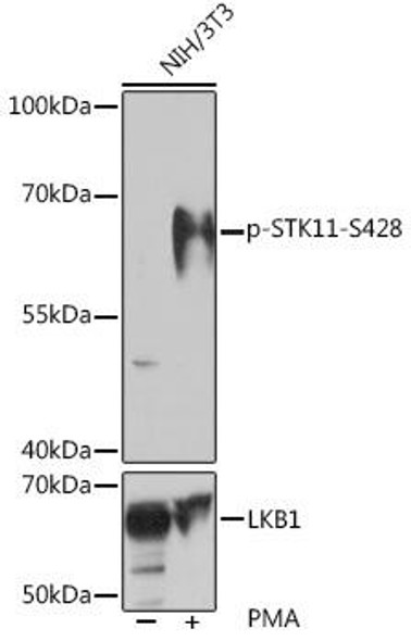 Cell Death Antibodies 2 Anti-Phospho-STK11-S428 Antibody CABP1108