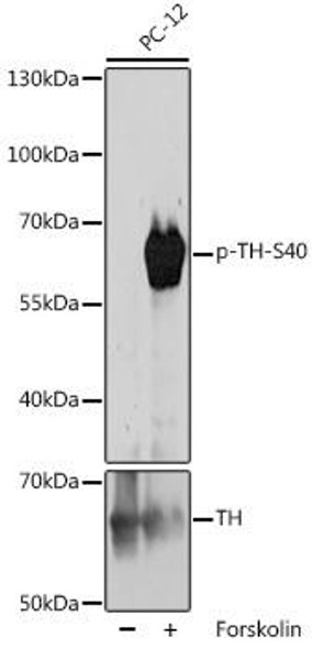 Metabolism Antibodies 3 Anti-Phospho-TH-S40 Antibody CABP1109