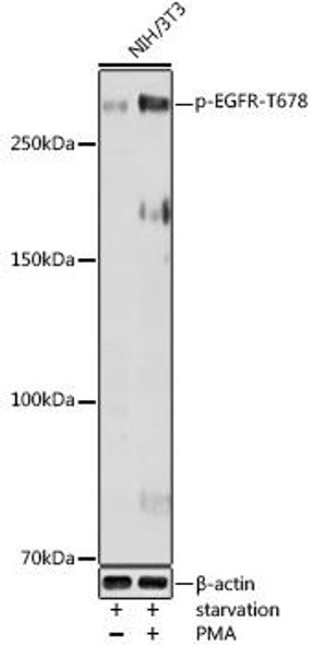 Immunology Antibodies 3 Anti-Phospho-EGFR-T678 Antibody CABP1114