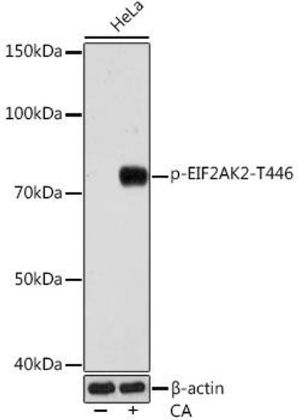 Immunology Antibodies 3 Anti-Phospho-EIF2AK2-T446 Antibody CABP1134