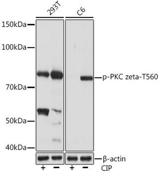 Immunology Antibodies 3 Anti-Phospho-PKC zeta-T560 Antibody CABP1149