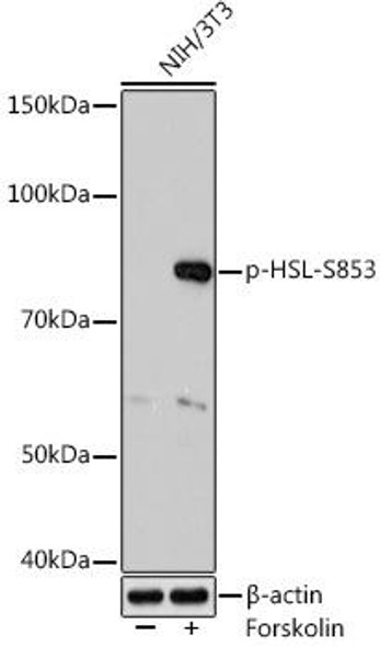Metabolism Antibodies 3 Anti-Phospho-HSL-S853 Antibody CABP1151