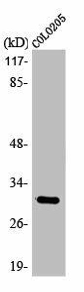 ABHD11 Antibody PACO00355