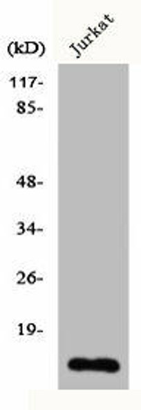 CDC42EP5 Antibody PACO00570