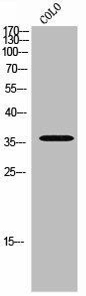 Phospho-ELK3 S357 Antibody PACO02640