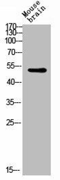 GATA3/GATA2 Antibody PACO02777