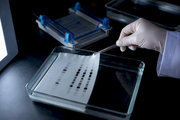 Drei Prüffragen für Western Blot Antikörper: Datenblattcheck fürs Labor