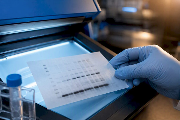 5 controles para validar anticuerpos para western blot en investigación