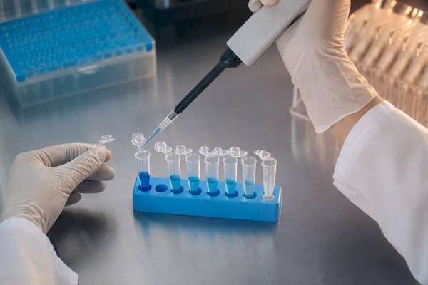 Dilución de anticuerpos: protocolo, cálculos y control de calidad