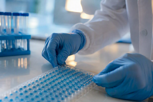 Validación de kit ELISA: qué medir para confiar en los datos
