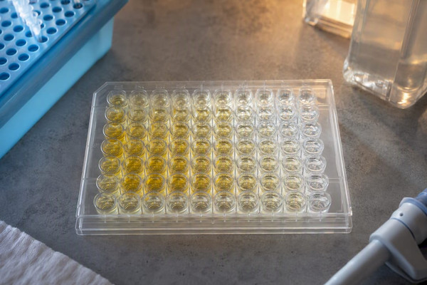 Optimiser un ELISA : les réglages qui changent vraiment le signal