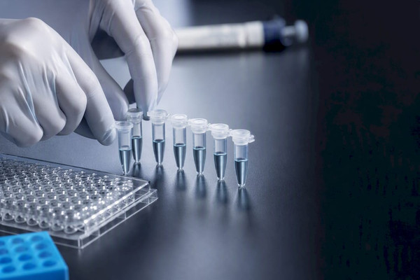 Calibration multipoints Elisa : la méthode qui évite les faux résultats