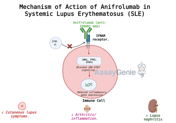 Anifrolumab: Transforming Lupus Treatment with Targeted Immunotherapy