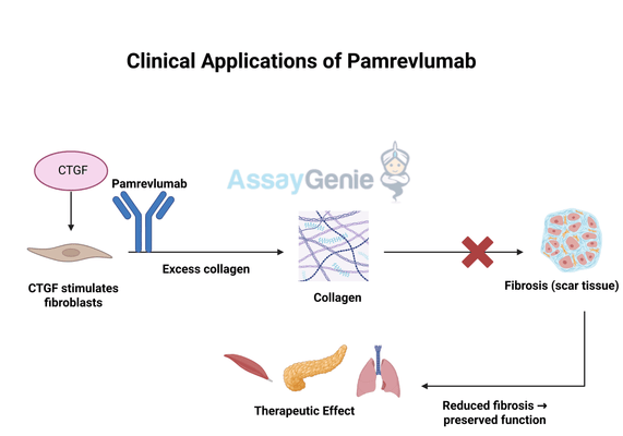 Pamrevlumab: Unveiling the Potential of Anti-Fibrotic Therapy in Clinical Trials and Research