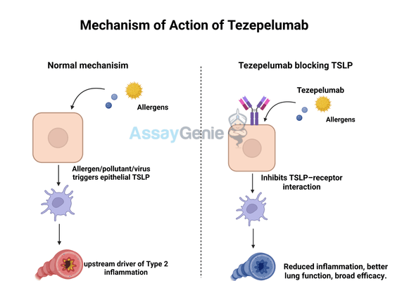 Tezepelumab: A Breakthrough in Severe Asthma Treatment and Research