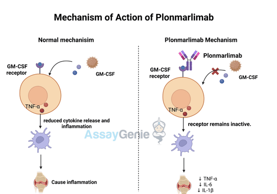 Plonmarlimab: Advancing Anti-GM-CSF Therapy in Inflammatory Diseases