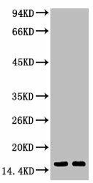 Anti-Tri-methyl-Histone H3K79 Antibody MACO0065