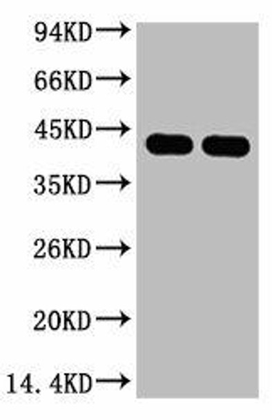 Anti-Plant actin Antibody MACO0107