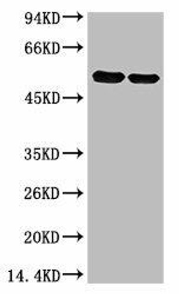 Anti-Rubisco Large Chain Antibody MACO0377