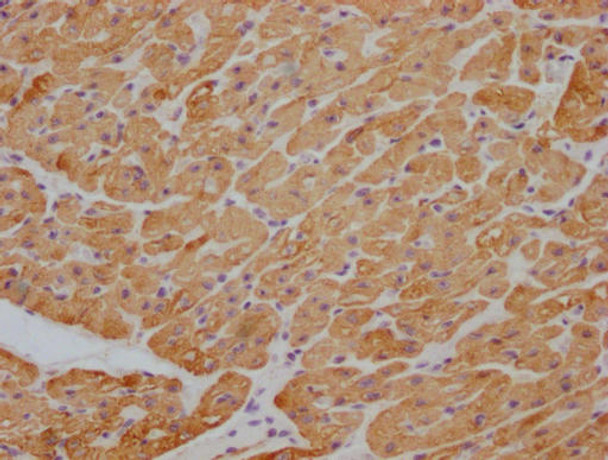 Anti-ACTB/POTEKP/ACTG1 Antibody MACO0470