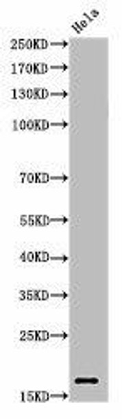 Acetyl-Histone H3 K27 Antibody PACO06049