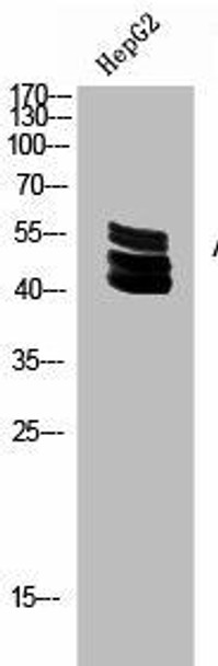 Acetyl-UBA52/RPS27A/UBB/UBC K27 Antibody PACO06073