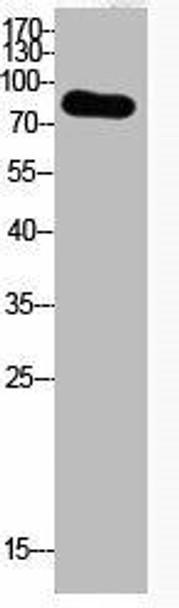 Acetyl-UBA52/RPS27A/UBB/UBC K29 Antibody PACO06079