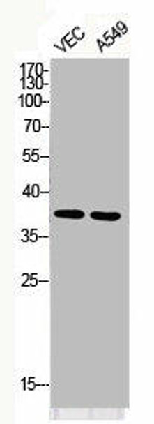 Phospho-JUN/JUND S73/100 Antibody PACO06094