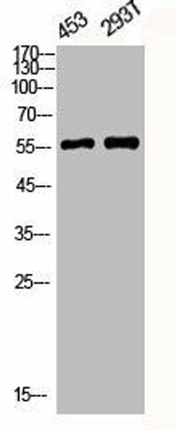 Phospho-CAMK2A/CAMK2B/CAMK2D T305 Antibody PACO06155