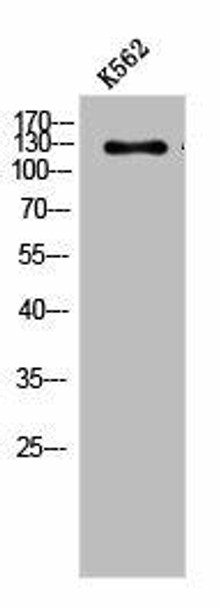 ABL1/ABL2 Antibody PACO06221