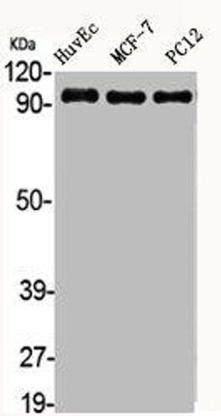 ACTN2/ACTN3 Antibody PACO06231