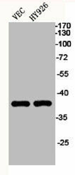 KLF1/KLF5/KLF7 Antibody PACO06456