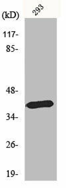 MTNR1B Antibody PACO06633