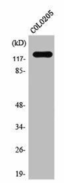 ST5 Antibody PACO06823