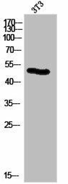 KRT14/KRT16 Antibody PACO06965