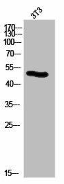 KRT14/KRT16 Antibody PACO06965