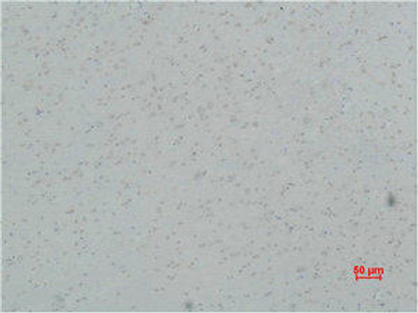 CACNG5 Antibody PACO07025