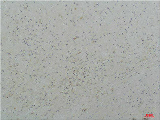 CACNA1I Antibody PACO07169